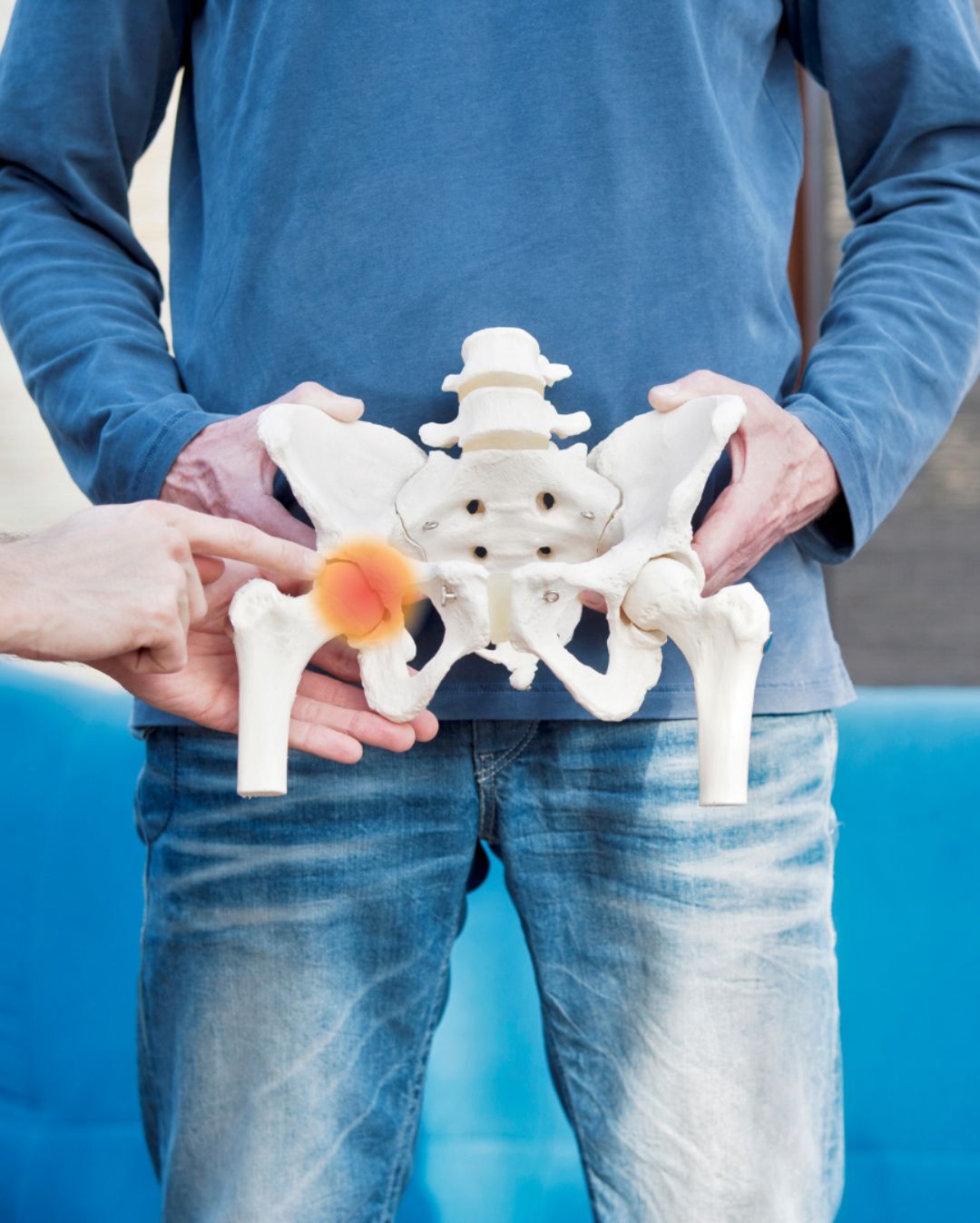 What is Arthritis and what are the associated symptoms