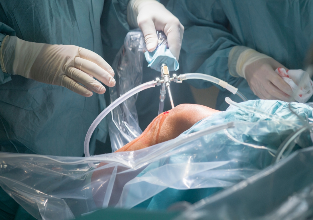 Indications for Revision Knee Replacement What Are the Risks