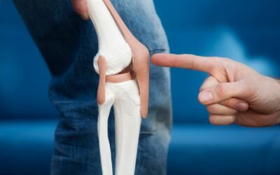Revision & Complex Revision Arthroplasty