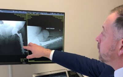 Getting to know your Orthopaedic Surgeon