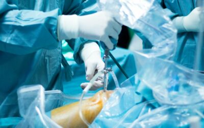 Your Inside Guide to Knee Arthroscopy