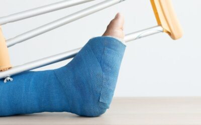 Preventing Bone Fractures in Ageing Patients