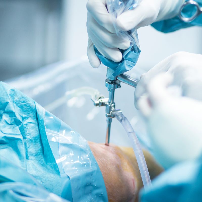 Arthroscopy is a valuable tool for addressing a wide range of issues